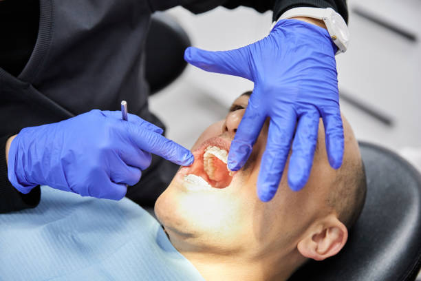 Best Emergency Wisdom Teeth Removal in Oneonta, NY